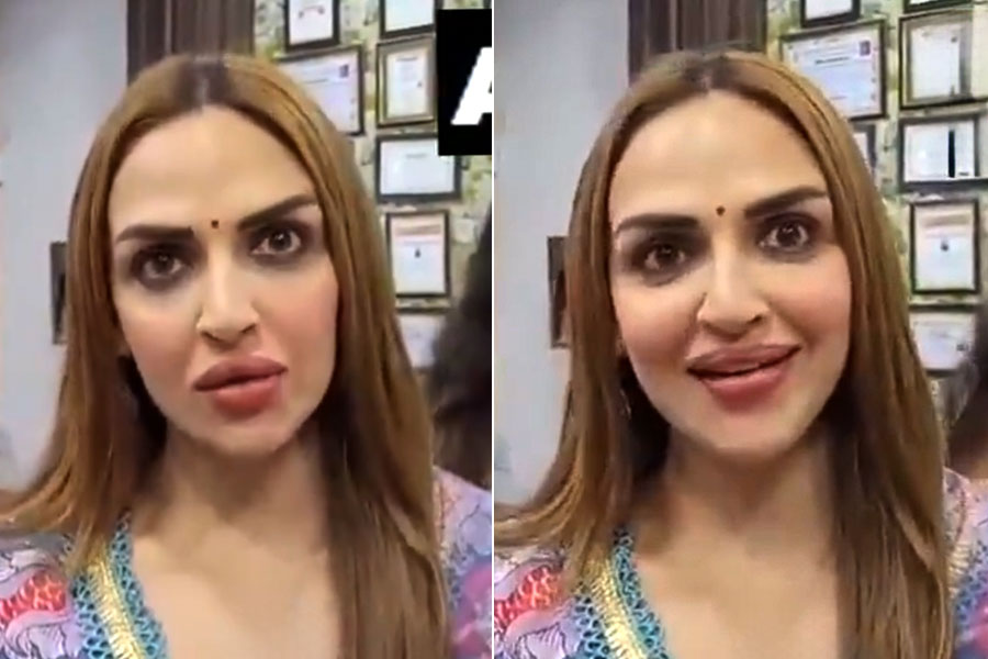 Esha Deol trolled for her 'plumped lips', netizens reacted sharply