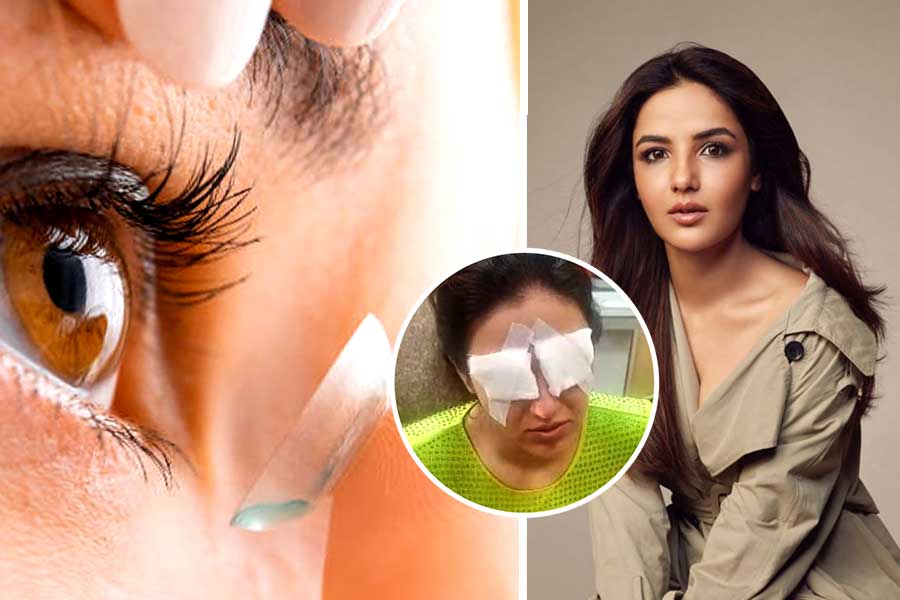 Jasmine Bhasin's corneas got damaged, know this Contact lens Use