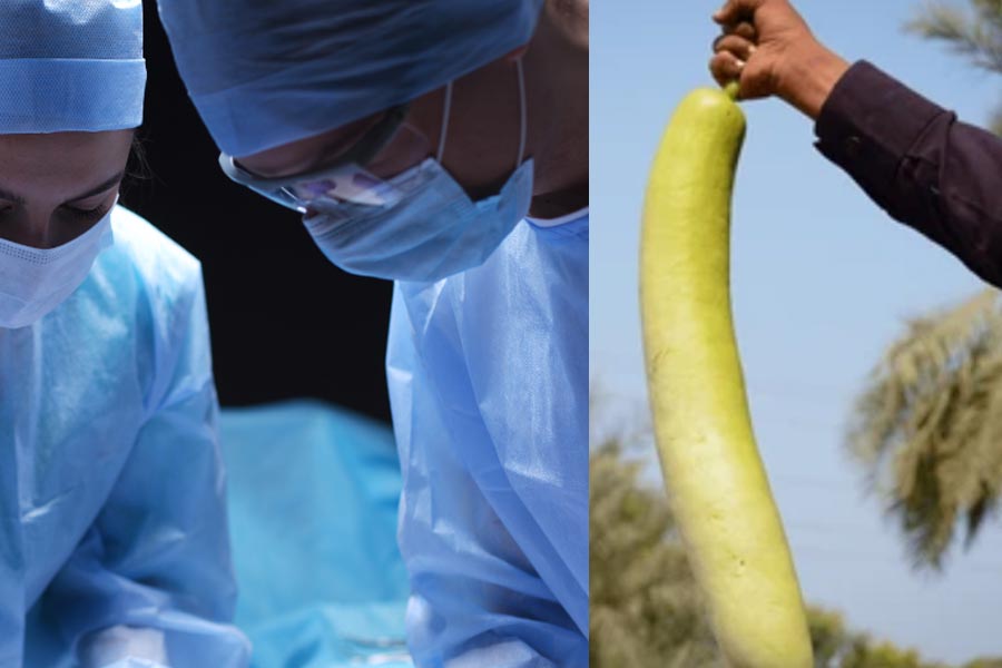 Doctors extract 16-inch bottle gourd from farmer's rectum in Madhya Pradesh
