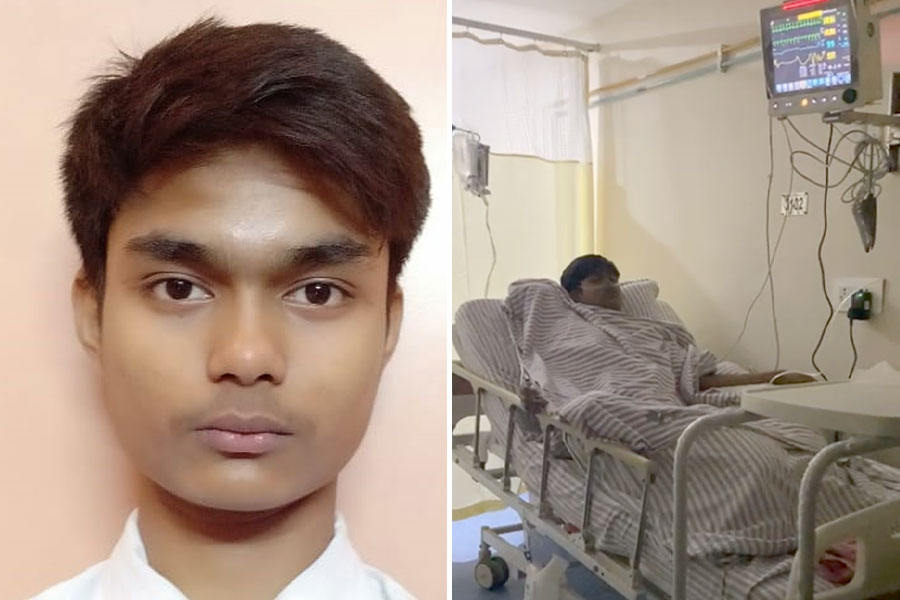 Barrackpore Incident: 'Accident' during practical class in a school, student suffers major burns