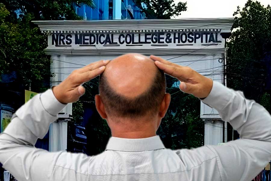 Massive demand for hair transplant at NRS Hospital